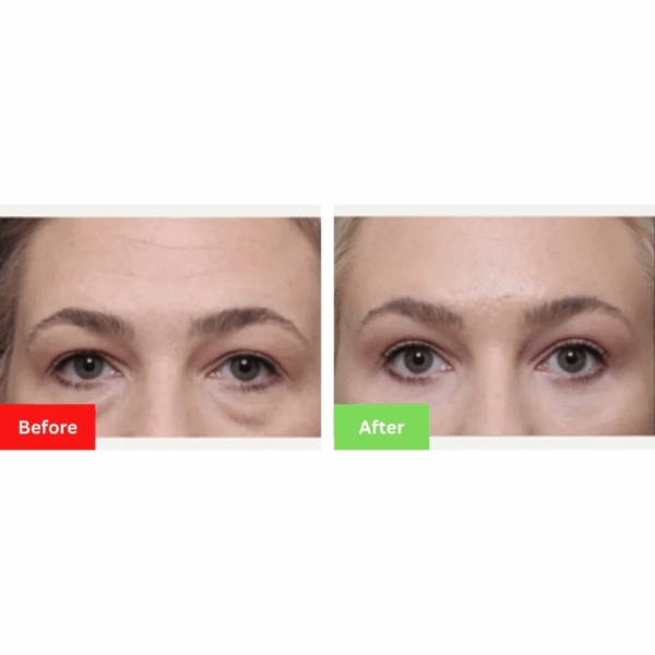 Teanux™ Coffee Eye Serum - Image 6