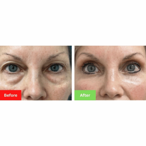 Teanux™ Coffee Eye Serum - Image 7